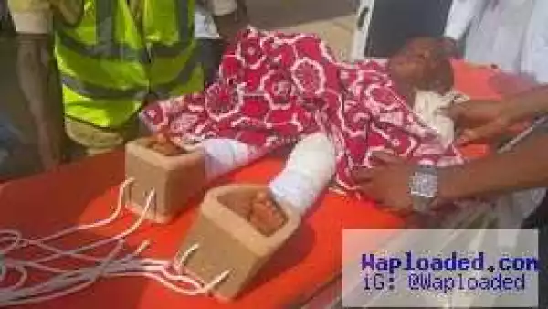 Baby Musa, toddler brutalised by step mum flown abroad for treatment (photos),